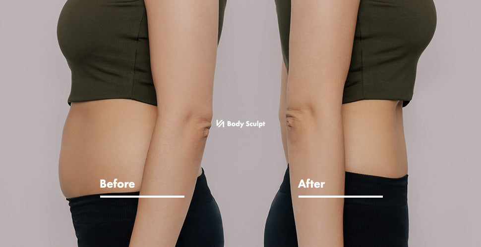 Builds muscle naturally — Body Sculpt — EMS Muscle Sculpting